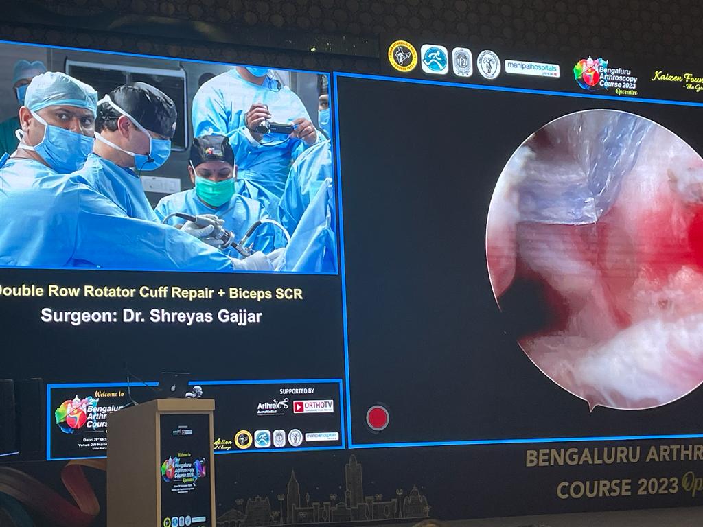 dr shreyash gajjar Arthroscopy Sports Orthopaedics